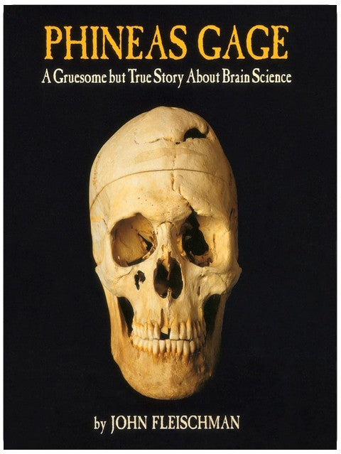Phineas Gage: A Gruesome but True Story About Brain Science – An Award-Winning Medical History Book for Kids (Ages 10-12)